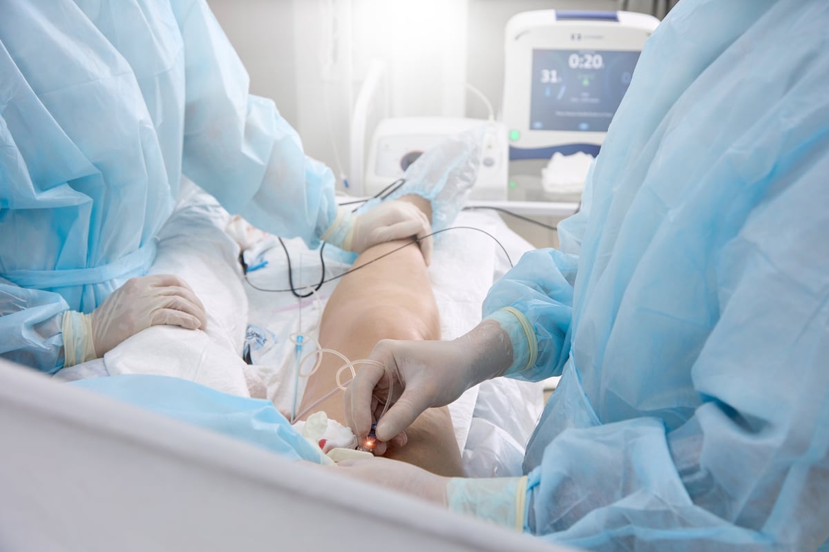 Treatment varicose veins team vascular surgeons Radiofrequency ablation